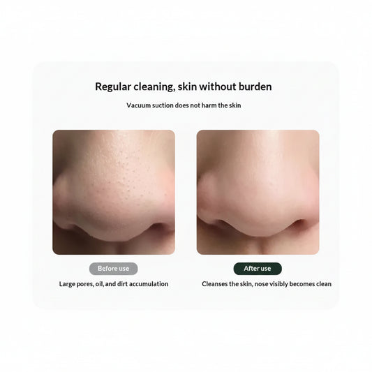 Pore Cleanser – Blackhead Remover