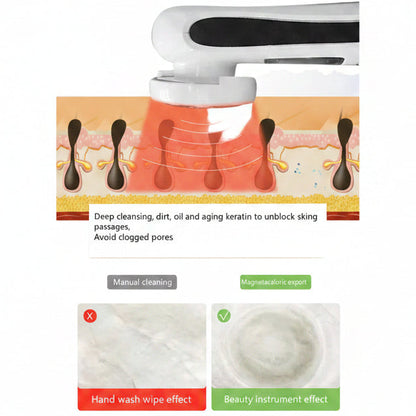 Ion Facial Beauty Device - Skin Tightening & Deep Cleansing
