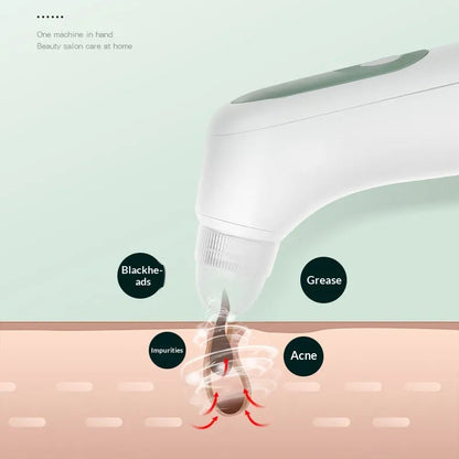 Pore Cleanser – Blackhead Remover